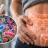 Čo zostane v črevách po antibiotikách? Odpoveď vedcov nie je úplne upokojujúca