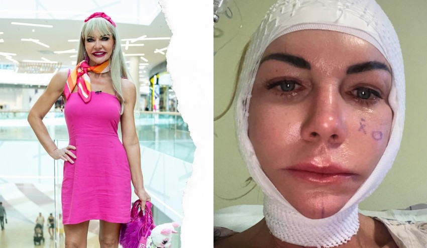 Dôverovala lekárke, zaplatila TVÁROU: Šokujúca spoveď Moniky Nemčokovej z Maniačok!