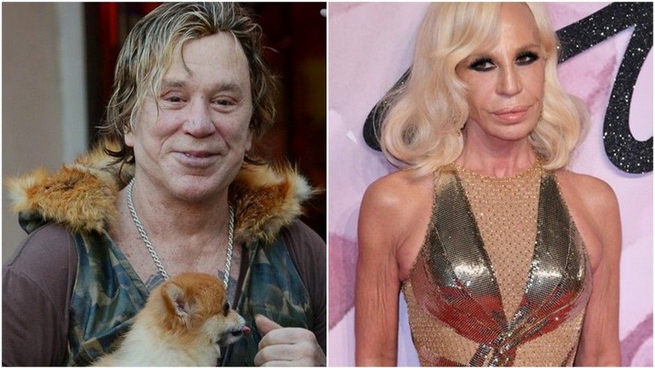 celebrity a plastiky