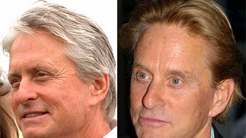 Michael Douglas plastika