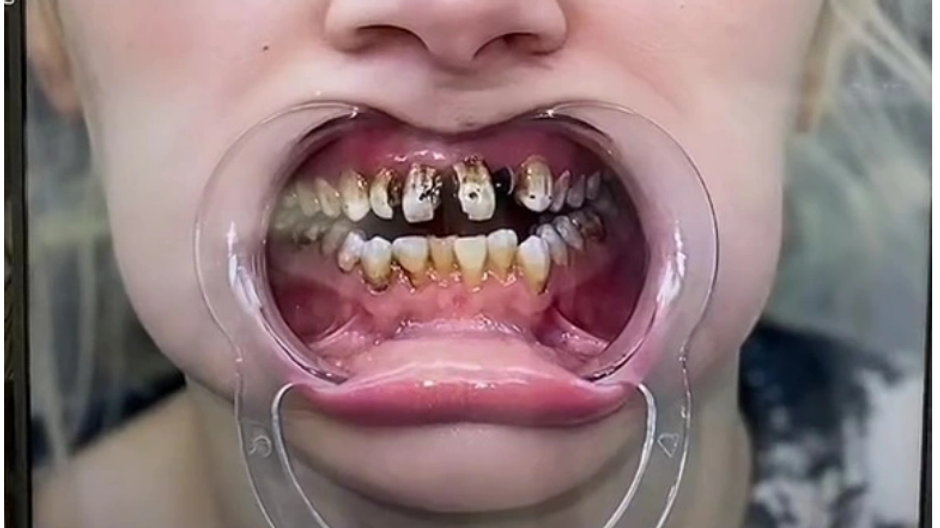 pribeh zeny pokazene zuby