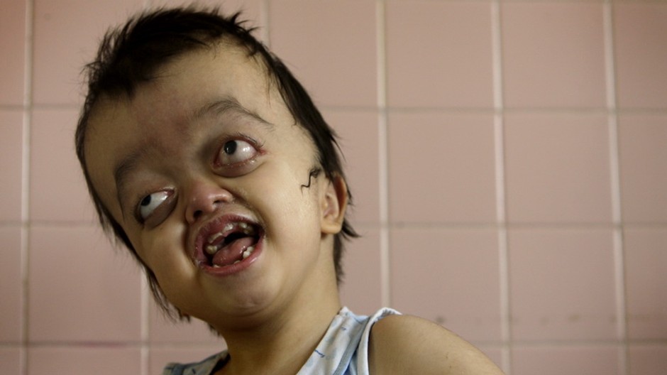 Agent Orange vietnamec 0