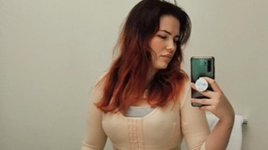 nepodarená plastika