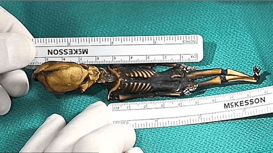 Atacama-Desert's-Mummified-Skeleton