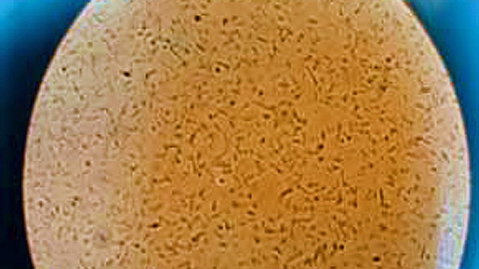 Baktéria vycvičená na výrobu bioplastov