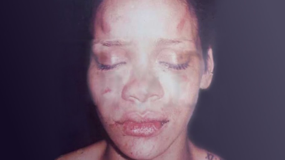 Speváčka Rihanna zbitá