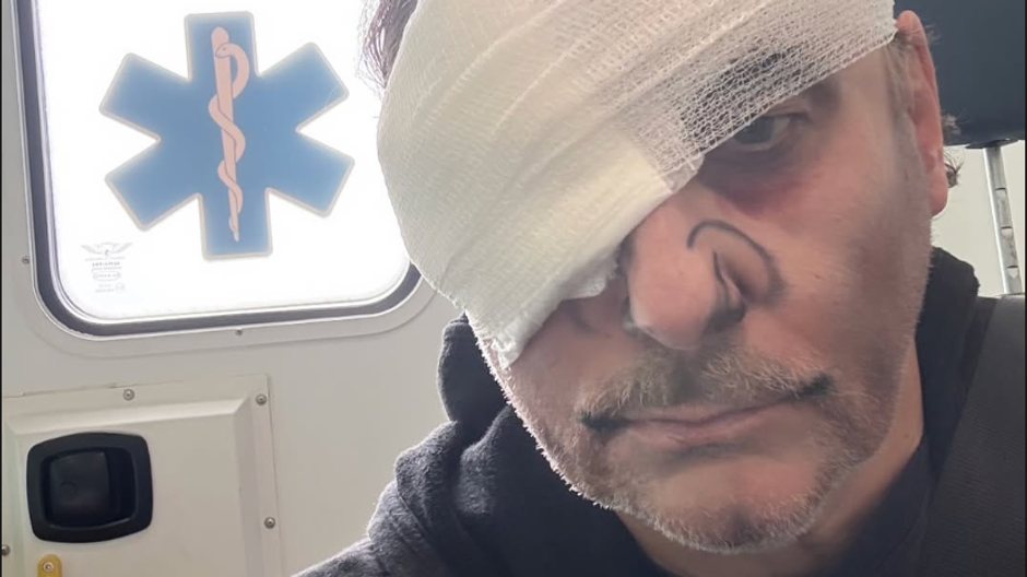 Marián Vojtko po úraze oka