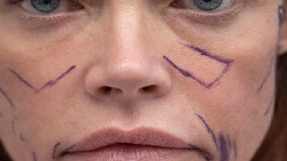 Denise Richards podstúpila facelift