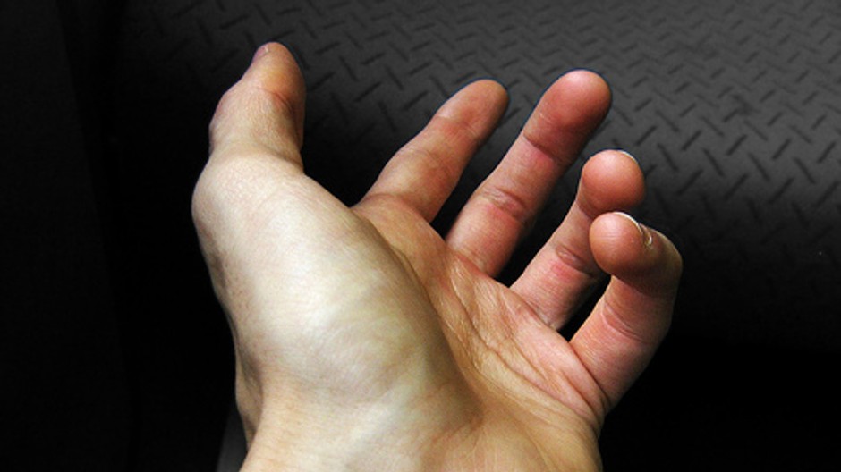 ruka otvorena dlan zily