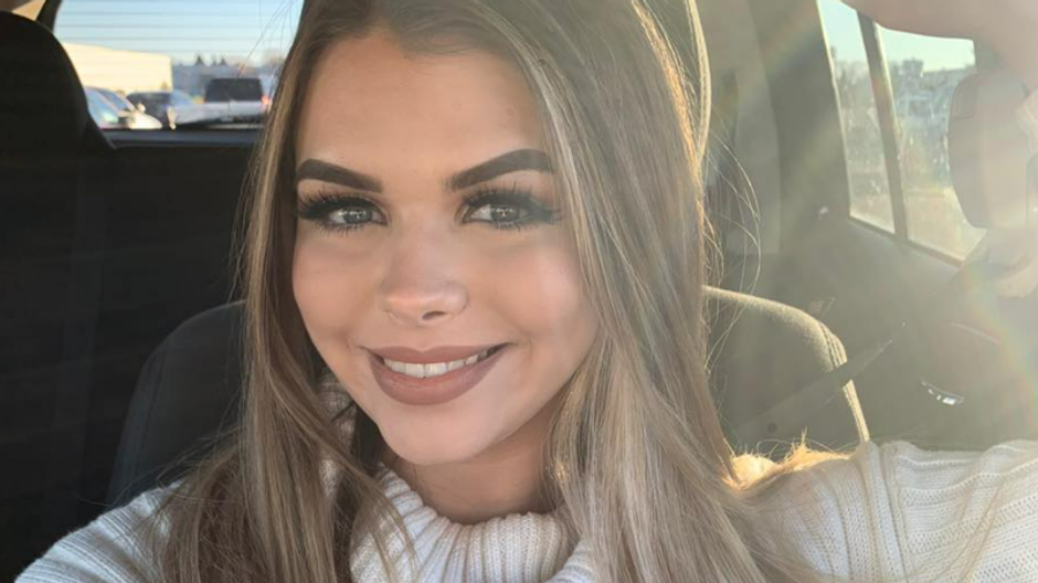 zmeny u tehotnej zeny