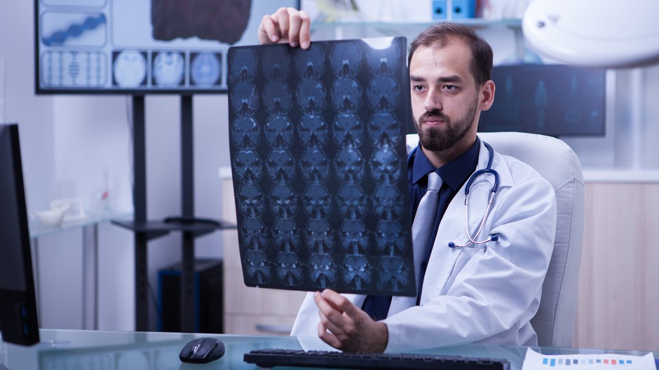 doctor-examining-brain-x-ray-doctor-holding-brain-radiograph