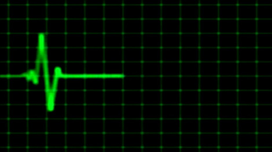Srdce zrádza aj mladých športovcov. Životom už zaplatili aj slovenskí reprezentanti720