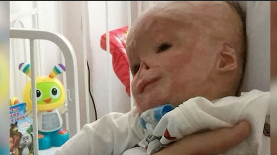 pribeh popalenho babatka 