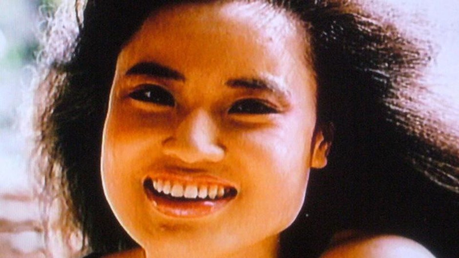 nevydarene plasticke operacie