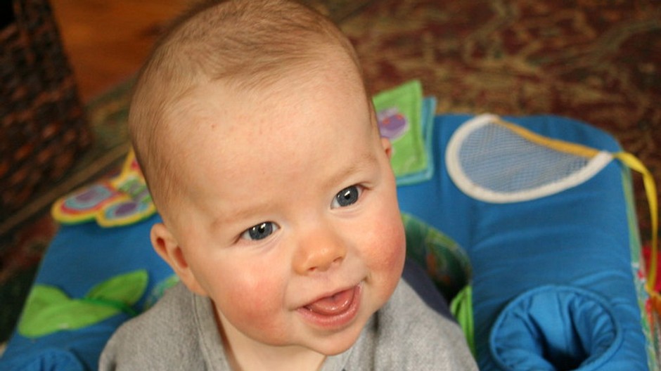 dieta usmev otvorene usta