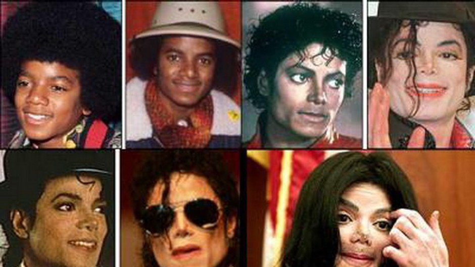 michael jackson plastika