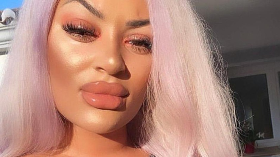 nevydarena plastika prs