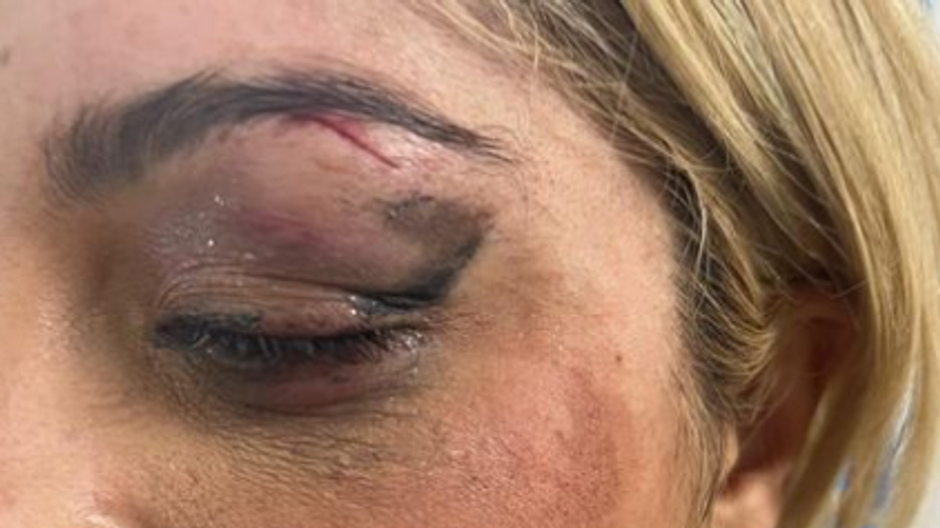 Bebe Rexha utok mobilom