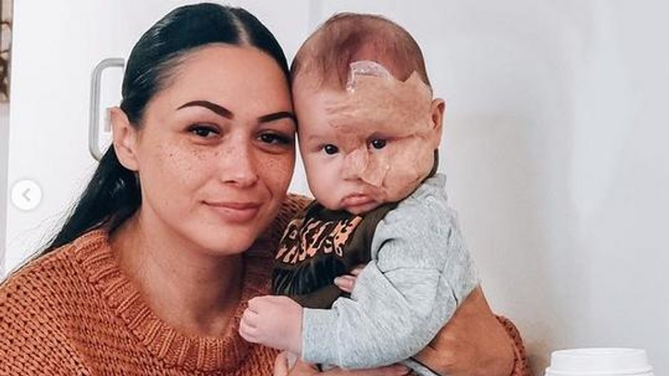 Brooke Atkins so synom