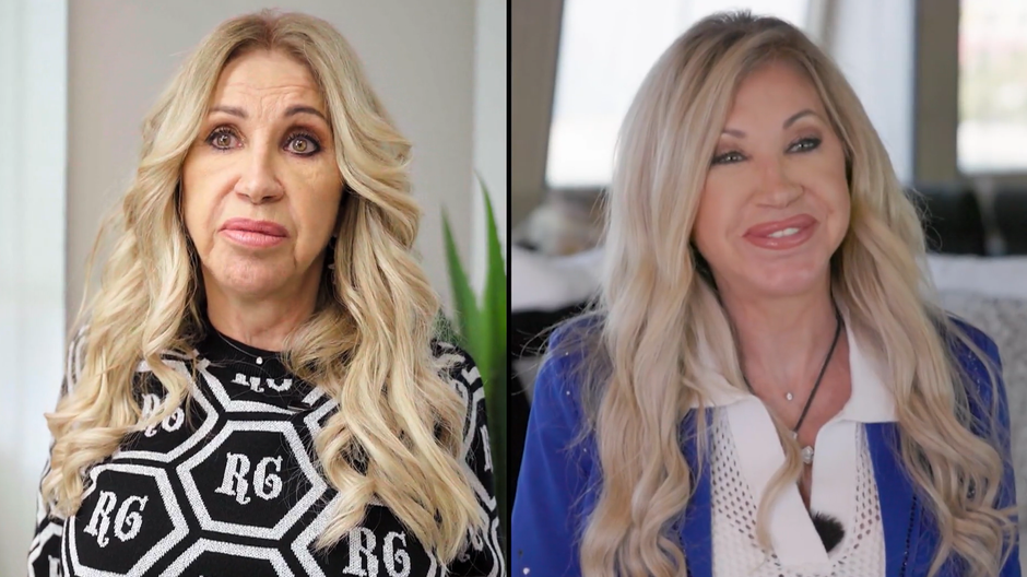 carmen geiss facelift