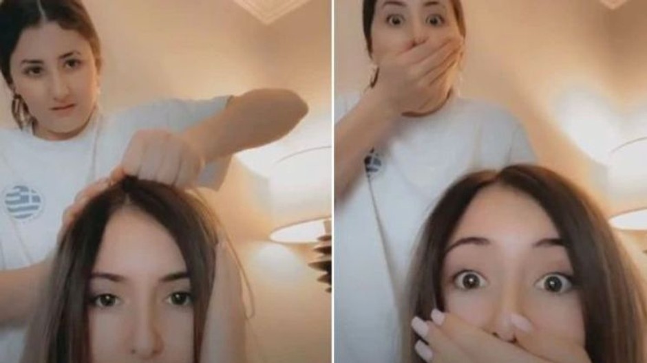 Scalp Popping challenge