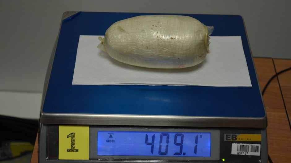 Gynekológ vytiahol zo ženy balíček drogy