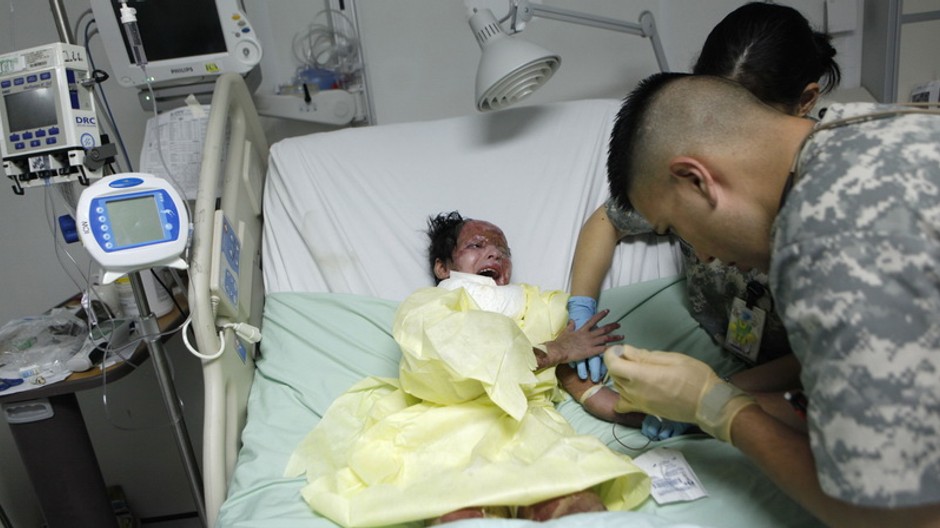 Afganské dievčatko Razia sa lieči z popálenín spôsobených bielym fosforom