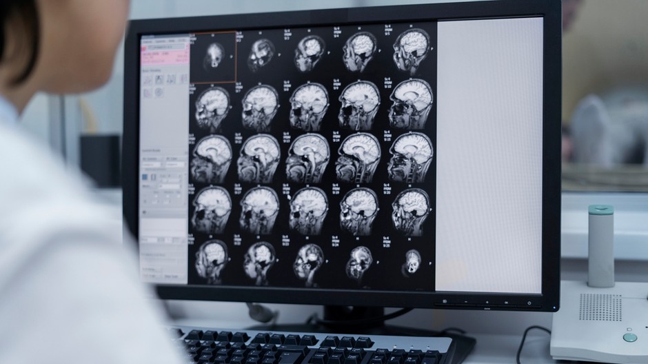 doctor-looking-ct-scan