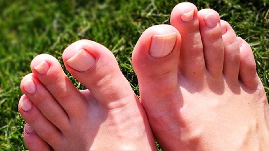 nohy, prsty na nohách
