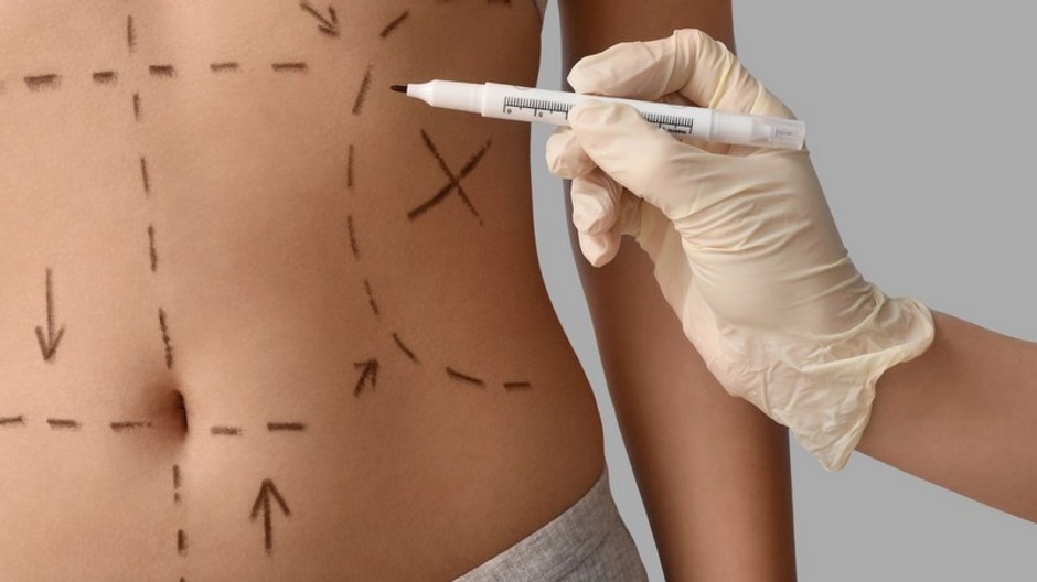 plastická operácia