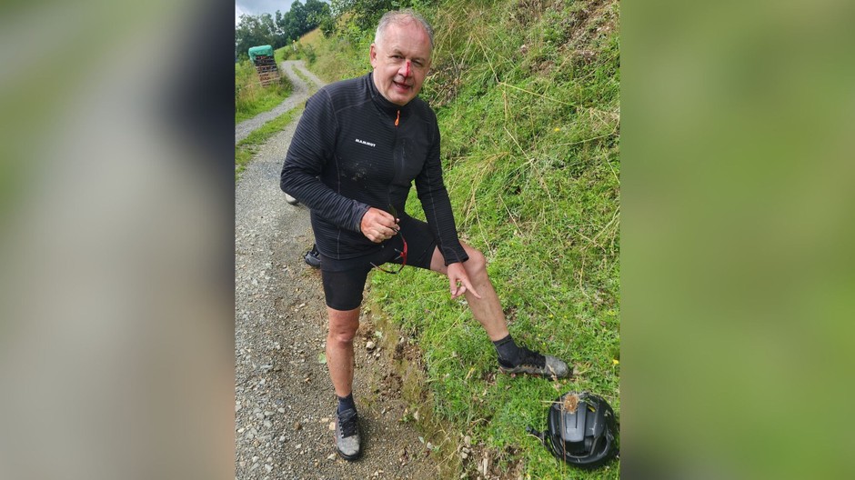 Andrej Kiska spadol na bicykli