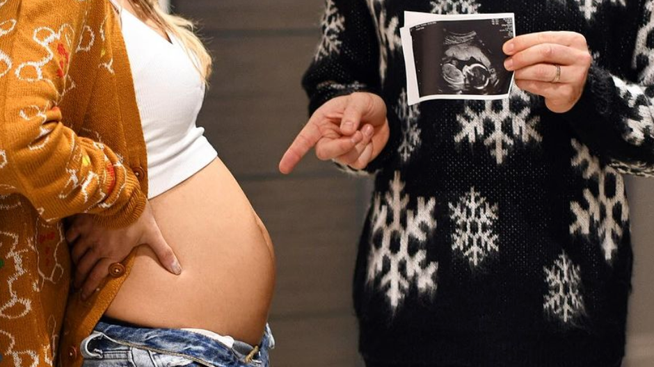 Olly Murs s manželkou