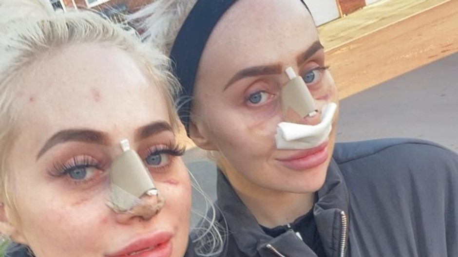 Daisy a Dolly Simpson 