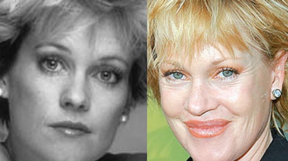 melanie griffith-plastika