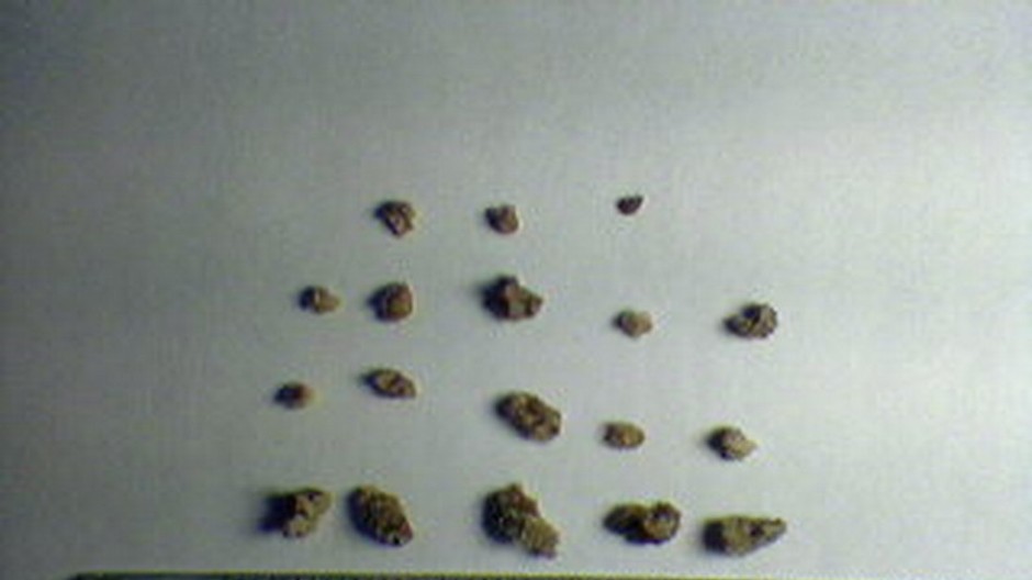 oblickove kamene s pravitkom