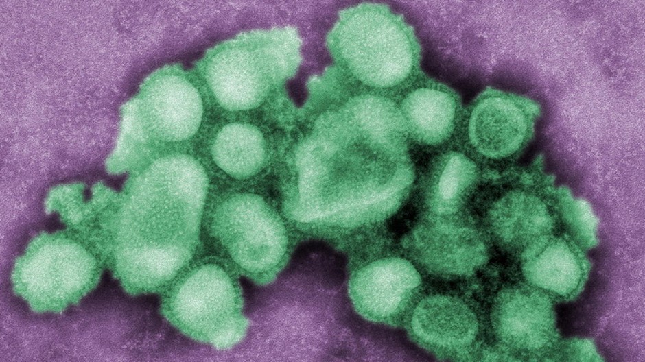 vírus prasacej chrípky