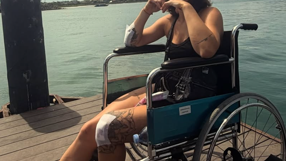 Paulína Bošková mala nehodu na Bali