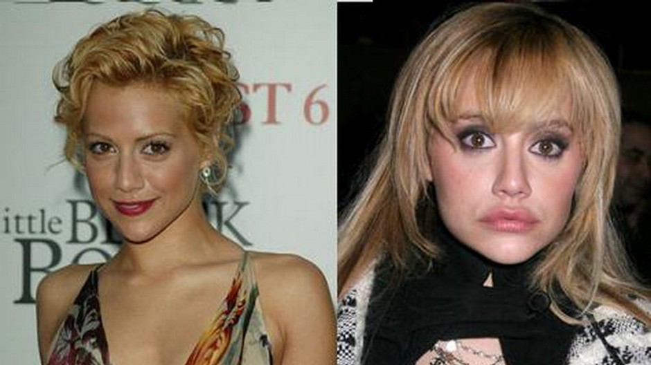 Brittany Murphy po plastike