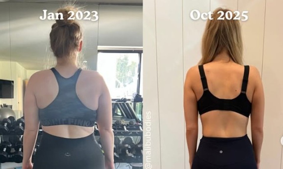 Speváčka zhodila viac ako 60 kíl. Priznala trénera, zákroky aj liek na chudnutie