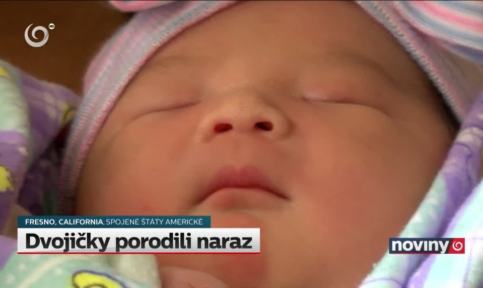 Dvojičky porodili naraz