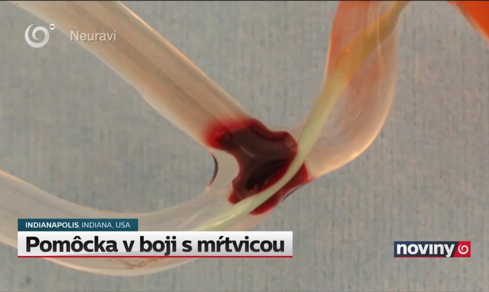 Pomôcka v boji s mŕtvicou