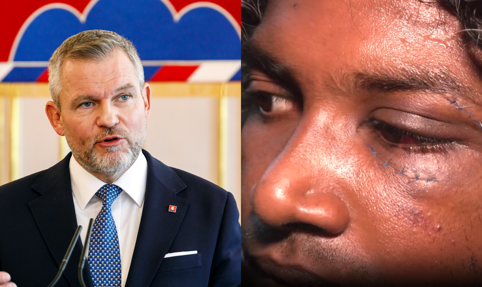 Prezident odsúdil násilie z nenávisti po útoku na cudzincov v Nitre
