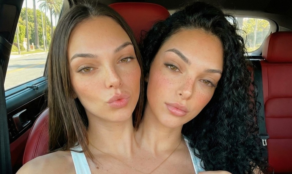 Najkrajšie siamské dvojičky na svete šokujú internet: Zázrak prírody alebo dokonalý podvod?