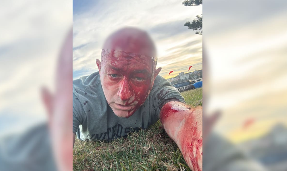 Prežil útok Hamasu, teraz zažil kviprelievanie na pláži v Austrálii. Právnik opísal chvíle hrôzy