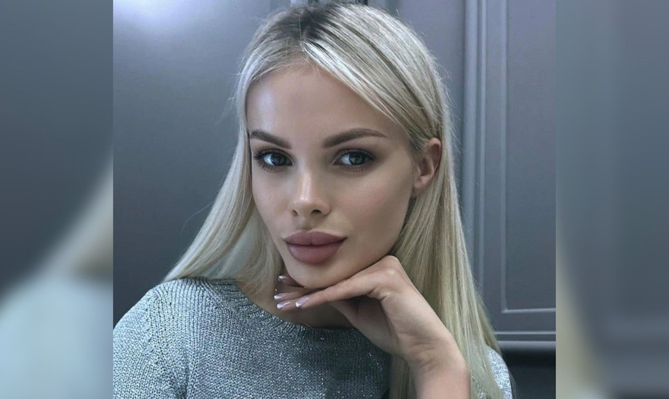 Modelka prišla o polovicu lebky. Útočník skolaboval po správe o treste