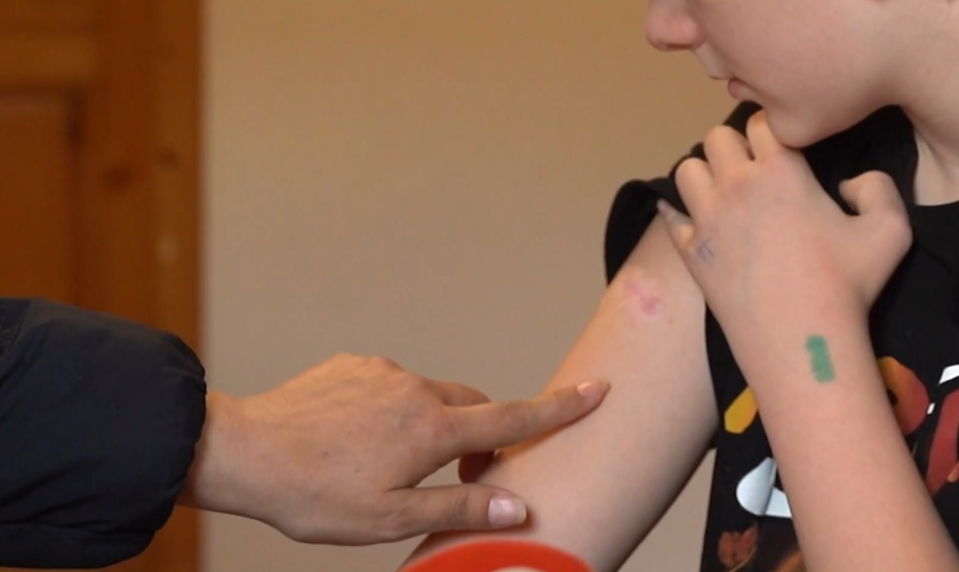 Po brutálnom útoku psa má Dávid (11) strach žiť normálny život. Von takmer nevychádza