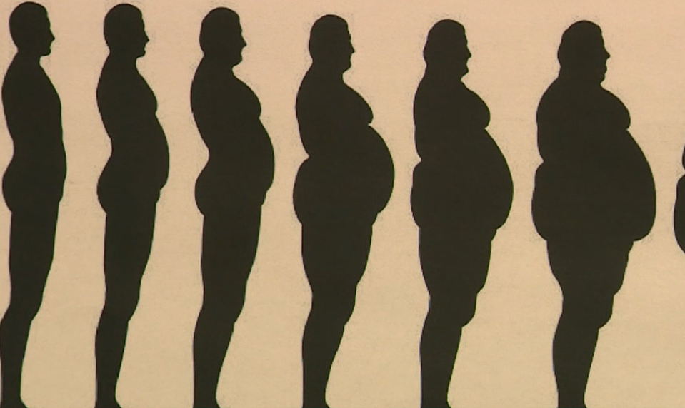 Liečba obezity sa mení: Nové lieky pomáhajú znižovať hmotnosť až o 20 percent