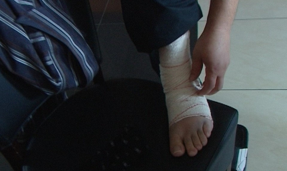 Vytkli ste si členok? Ak počujete tento zvuk, určite sa neliečte sami!