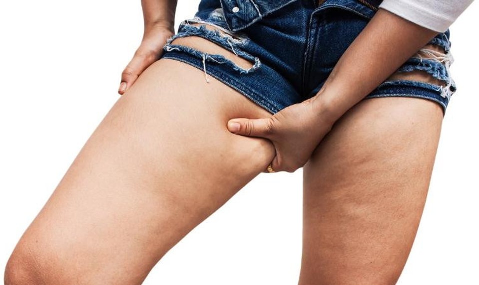 Ukladá sa vám tuk v stehnách? Pozor na srdce!