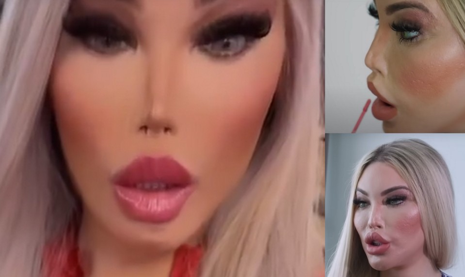 Čakala obdiv, naháňa STRACH. Z muža sa stala žena, zo ženy plastikové monštrum